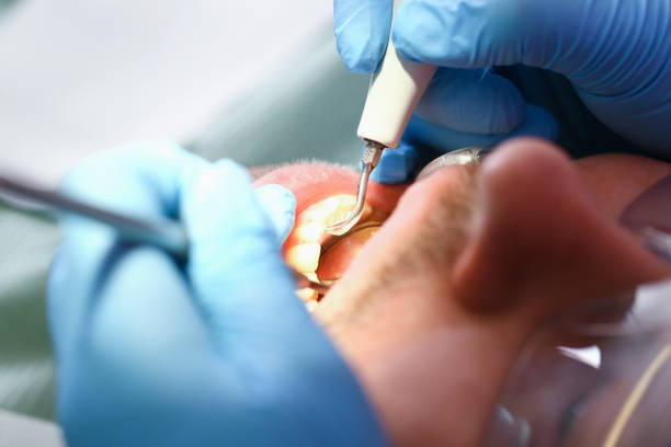 Best Chipped Tooth Repair Near Me  in Lomita, CA