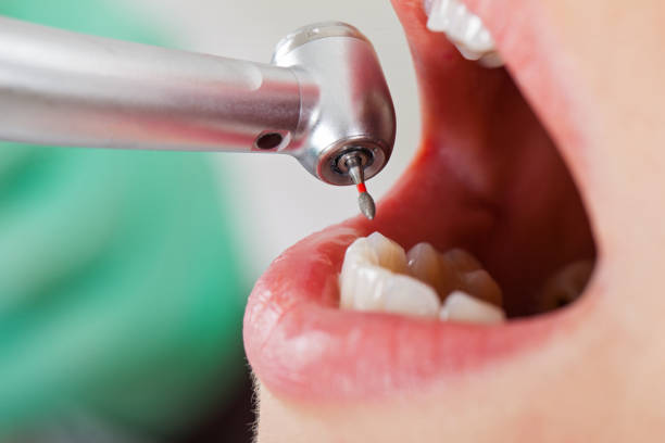 Best Root Canal Emergency Dentist  in Lomita, CA